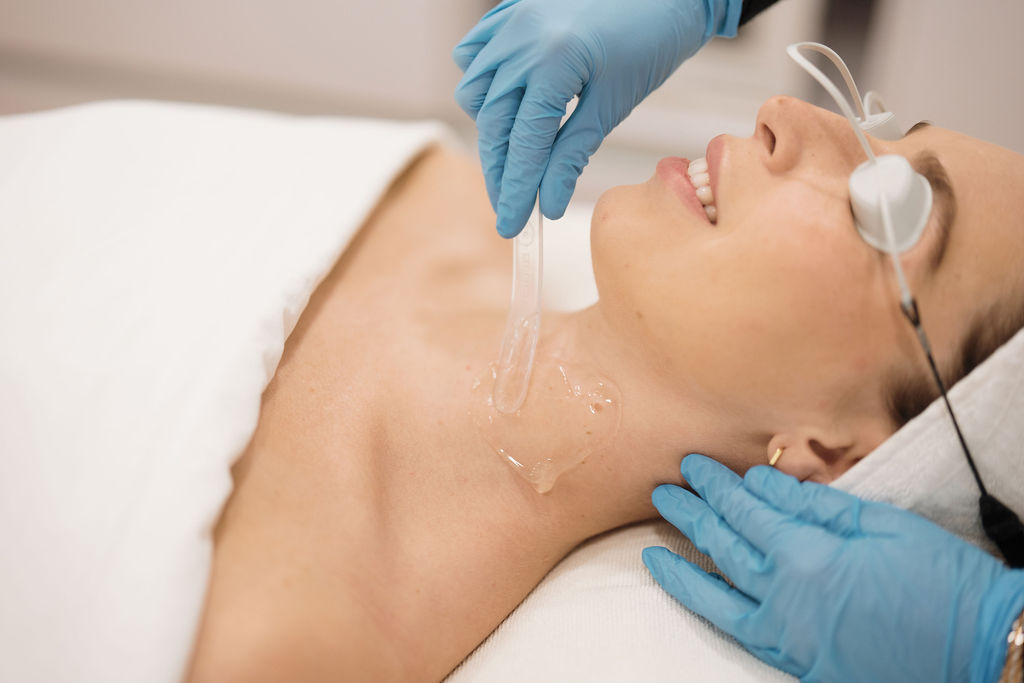 Tratamiento de cicatrices de acné con Venus Viva en Sevilla