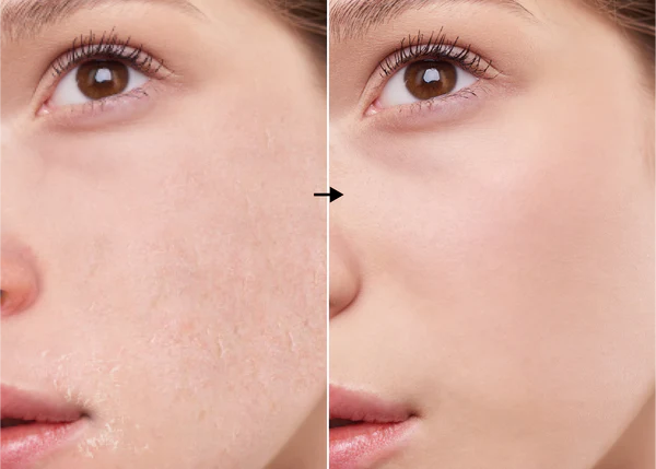D-Panthenol (vitamina B5) 5 % de la marca Universkin: Resultados