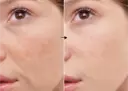 Isoflavonas 2% de la marca Universkin: Resultados