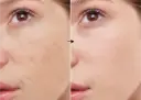 Retinol 0.2% de la marca Universkin: Resultados