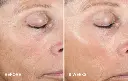 Active Peel System de la marca Is Clinical: Resultados en 8 semanas